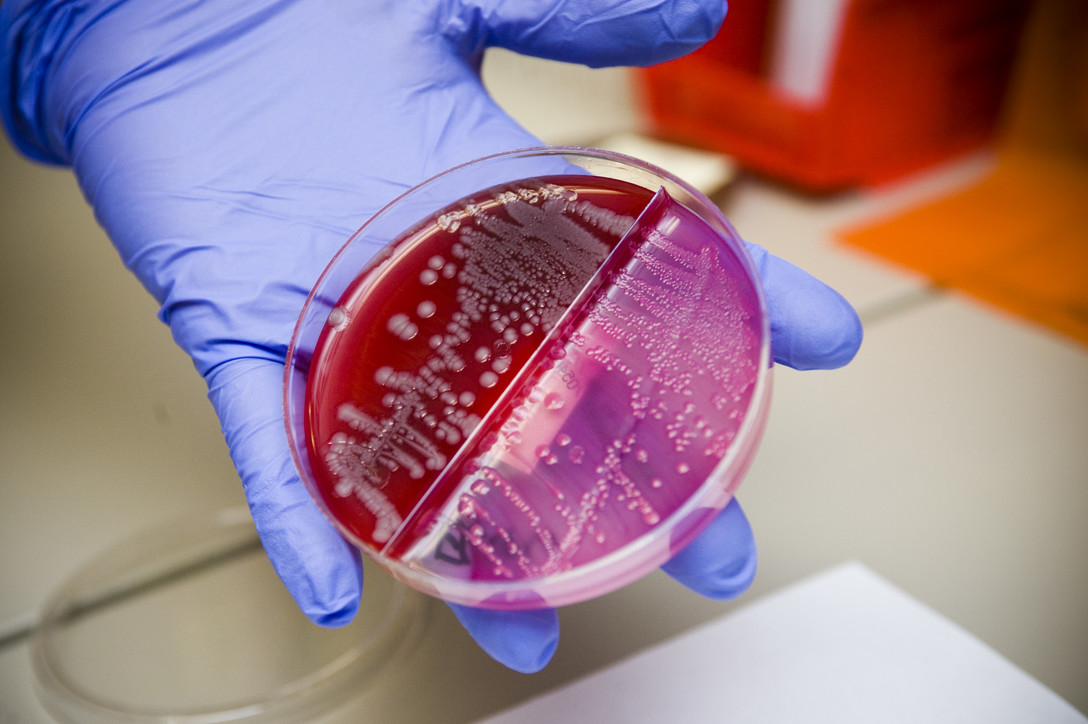 Gloved hand holding a stained petridish